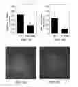 Fig. 02 - COMPOSITIONS AND METHODS FOR TREATING OCULAR EDEMA, NEOVASCULARIZATION AND RELATED DISEASES