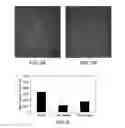 Fig. 03 - COMPOSITIONS AND METHODS FOR TREATING OCULAR EDEMA, NEOVASCULARIZATION AND RELATED DISEASES