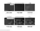 Fig. 05 - COMPOSITIONS AND METHODS FOR TREATING OCULAR EDEMA, NEOVASCULARIZATION AND RELATED DISEASES