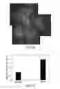 Fig. 07 - COMPOSITIONS AND METHODS FOR TREATING OCULAR EDEMA, NEOVASCULARIZATION AND RELATED DISEASES