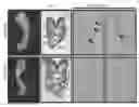 Fig. 01 - Genetically modified pig cells with an inactivated Etv2 gene