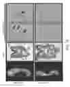 Fig. 02 - Genetically modified pig cells with an inactivated Etv2 gene