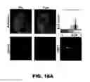 Fig. 32 - ANTIBODIES TO TAU