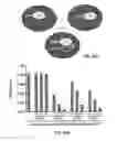 Fig. 47 - ANTIBODIES TO TAU