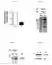 Fig. 02 - MODIFIED CANCER CELL LINES AND USES THEREOF
