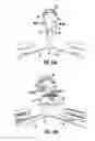 Fig. 12 - VENTILATION SYSTEM FOR TILE ROOFS