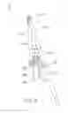 Fig. 07 - Anchor fence post assembly