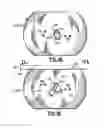Fig. 15 - Method and apparatus for dropping a pump down plug or ball