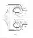 Fig. 02 - CONSTANT-VOLUME COMBUSTION SYSTEM FOR A TURBINE ENGINE OF AN AIRCRAFT ENGINE