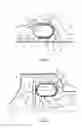 Fig. 04 - CONSTANT-VOLUME COMBUSTION SYSTEM FOR A TURBINE ENGINE OF AN AIRCRAFT ENGINE