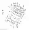 Fig. 05 - Interrupter and differential