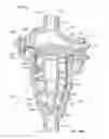 Fig. 16 - Stacked disk check valve