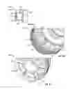 Fig. 08 - Stacked disk check valve