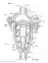 Fig. 16 - Stacked disk check valve