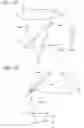 Fig. 15 - Projection type image display apparatus