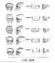 Fig. 35 - Methods and systems for producing an implant