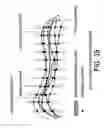 Fig. 44 - Methods and systems for producing an implant