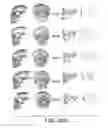 Fig. 49 - Methods and systems for producing an implant
