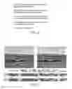 Fig. 07 - Joint acoustic and visual processing