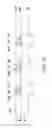 Fig. 06 - Pad structure and manufacturing method thereof