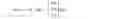 Fig. 43 - Filter component tuning method