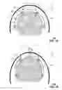 Fig. 02 - Lever-activated shock abatement system and method