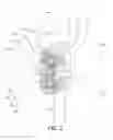 Fig. 04 - Oral care implement