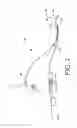 Fig. 03 - RECEPTACLE ATTACHMENT