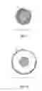 Fig. 13 - MEDICAL TOOL WITH IMAGE ENHANCING FEATURES