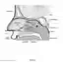 Fig. 10 - Method of performing a sphenopalatine ganglion block procedure