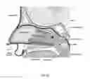 Fig. 12 - Method of performing a sphenopalatine ganglion block procedure