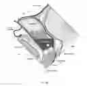Fig. 14 - Method of performing a sphenopalatine ganglion block procedure