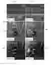 Fig. 07 - Methods and systems for enhancing microangiography image quality