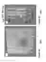 Fig. 08 - Methods and systems for enhancing microangiography image quality