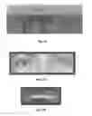 Fig. 09 - Device and method for distance determination and/or centering using corneal reflections