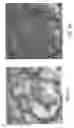 Fig. 06 - Intraoperative guidance system for tumor surgery