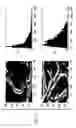 Fig. 07 - Intraoperative guidance system for tumor surgery