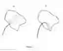 Fig. 08 - Heart mapping system