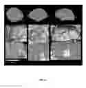 Fig. 08 - System and method for intraoperative characterization of brain function using input from a touch panel device