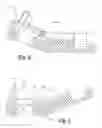 Fig. 07 - VALVE RAKE AND MOUNT FOR SURGICAL RETRACTOR
