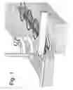 Fig. 02 - Suture stitches for continuous surgical suturing