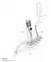Fig. 22 - Minimally invasive screw extension assembly