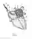 Fig. 02 - Apparatus and method for intra-cardiac mapping and ablation
