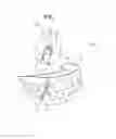 Fig. 02 - TRACTION DEVICE FOR CLEAR ALIGNER, CLEAR ALIGNER AND MANUFACTURING METHOD THEREOF