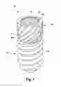 Fig. 02 - Dental implant