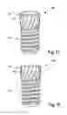 Fig. 06 - Dental implant