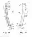 Fig. 02 - Sealable endovascular implants and methods for their use