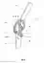 Fig. 07 - Dynamic correction splint