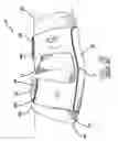 Fig. 05 - Elbow brace
