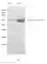 Fig. 02 - METHOD FOR IMPROVING AN INTESTINAL MICROFLORA AND PROMOTING GROWTH OF ANIMALS BY USING COLICIN OR MICROORGANISM CAPABLE OF EXPRESSING THE SAME